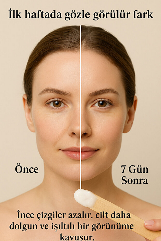 Cosmolive Yaşlanma Ve Kırışıklık Karşıtı Nemlendirici Yüz Göz Çevresi Altı Cilt Kremi Gece Yağlı Su Bazlı Kuru