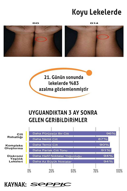 Cosmolive Yüz & Vücut Kremi | Cilt Beyazlatıcı | Leke Karşıtı | Nemlendirici | Cam Kavanoz | Genital Bölge